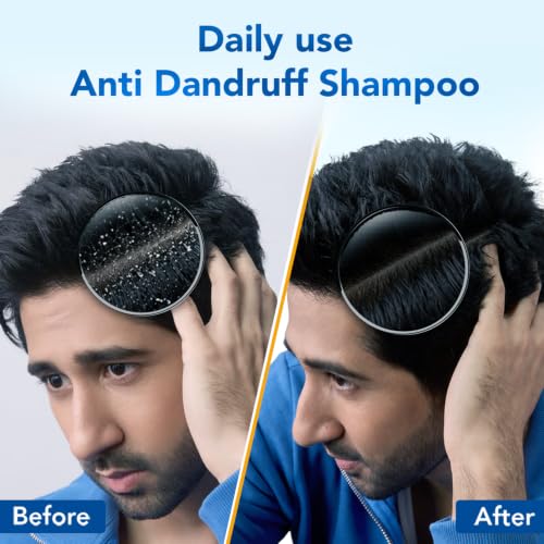 Image of Scalpe Pro Daily Anti-Dandruff Shampoo | Removes Dandruff from Source | Prevents Itching & Irritation | Scalpe Science | Climbazole Formulation | Dermatologically Tested | For Women & Men | 650ml