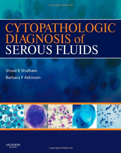 Buy Cytopathologic Diagnosis of Serous Fluids — BookShops.in