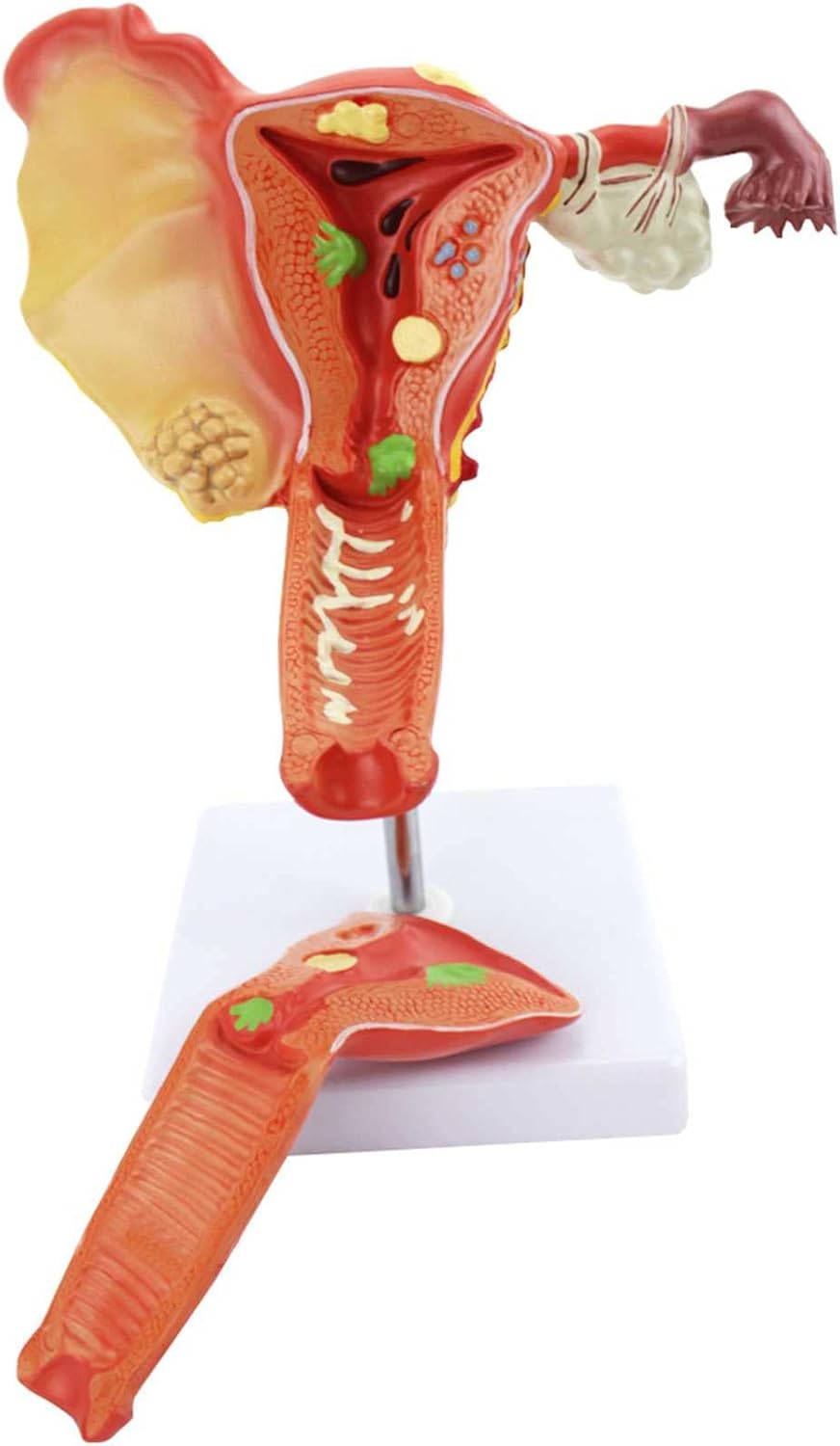 子宮 模型 看護 医学 産婦人科 人体 模型 断面図 昭和レトロ 医科学