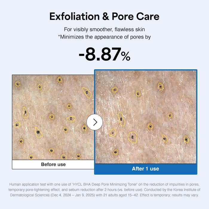 BHA Blackhead Power Toner (6.76fl oz), Daily Exfoliating Face Toner with Willow Bark Water for Oily, Acne-Prone Skin, Minimizes Pores & Controls Excess Sebum, Korean Skincare - Image 4