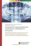 evo x x beam rods  Tomografia Computadorizada Cone Beam x Radiografia Periapical: Diagnóstico de fratura radicular por meio da Tomografia Computadorizada Cone Beam comparada a Radiografia periapical