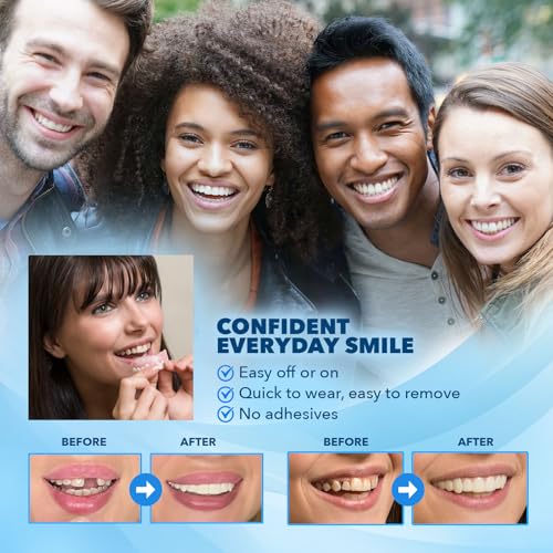 Imako Premium Cosmetic Uppers - 1 Pack - Small, Bleached White - DIY Smile Makeover - Made in USA3