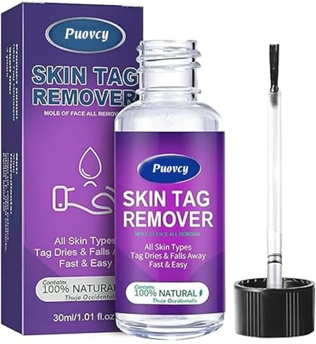 Skin tag Removal kit: Natural Removal Without Leaving Traces, Non-irritating, Hand and Body wart Remover, Suitable for All Kinds of People 30ml