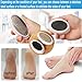 Generic Foot Dead Skin Remover, Heel Scraper for Callus, Cracked Removal, Portability Heels Peeler File
