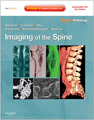 Imaging of the Spine: Expert Radiology Series, Expert Consult-Online and Print
