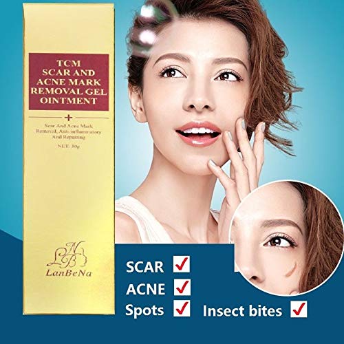 TSSPLUS 30g scar and acne mark removal gel ointment mark removal cream,Skin Repair Treatment