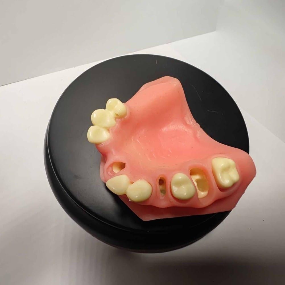 Modèle d'Implant Dentaire Modèle d'Implant Dentaire pour Formation, Enseignement, Démonstration et Étude