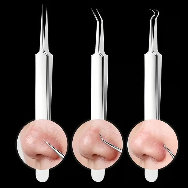 Miniatura 7 de Removedor de pinzas de puntos negros, kit de removedor de puntos negros, kit de herramientas profesional para reventar, para frente, facial y nariz