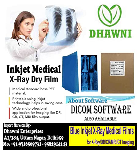 Image of Dhawni Inkjet Medical X-Ray Film | COLOUR : Blue | SIZE: 8 inch X 10 inch | | THICKNESS: 210 Micron | For X-Ray, CR, DR (300 sheet)