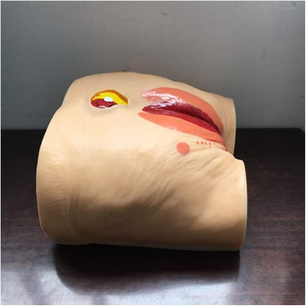 Outils de modèle d'enseignement, modèle de Soins des escarres de décubitus, modèle de Soins des escarres pour Personnes âgées, modèle d'enseignement du Mannequin, simulateur Humain