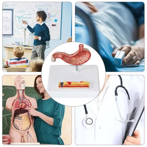 Modèle de stomach pathologique résistant avec pièces amovibles d'étude - 7