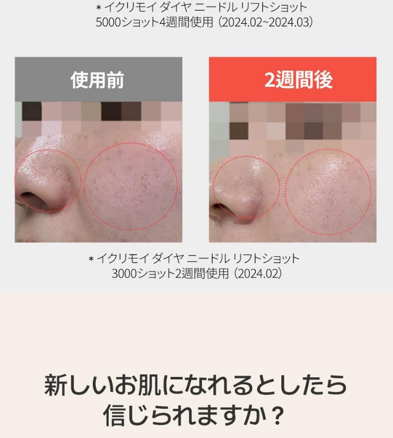 Amazon.co.jp: ECLIMOI(イクリモイ)ダイヤリフトショット1000 毛穴