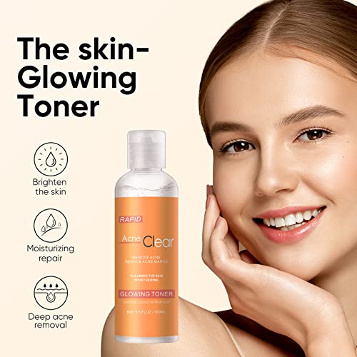 Acne Clear Toner Facial Toner For Acne, Toner For Face Moisturizing, Hydration Face Toner For Acne Remove,Glowing Toner For Minimizes Pores Cleanses Tone For Acne Marks 3.5 Oz #TOP3