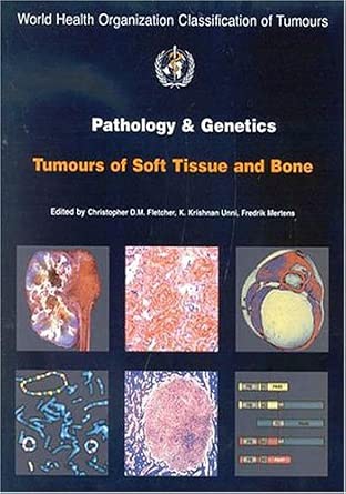Amazon.in: Buy Pathology and Genetics of Tumours of Soft Tissue and ...