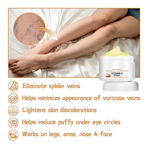 Facecoi VARICOSE VEINS MIRACLE CREAM Spider Varicose Veins Miracle Cream, Remove Varicose Veins For Legs thumb #5