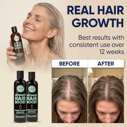 Haarwachstum Shampoo gegen Haarausfall – Biotin und Koffein Haarwuchs Shampoo für Frauen und Männer – haarwachstum beschleunigen, reduziert Haarverlust