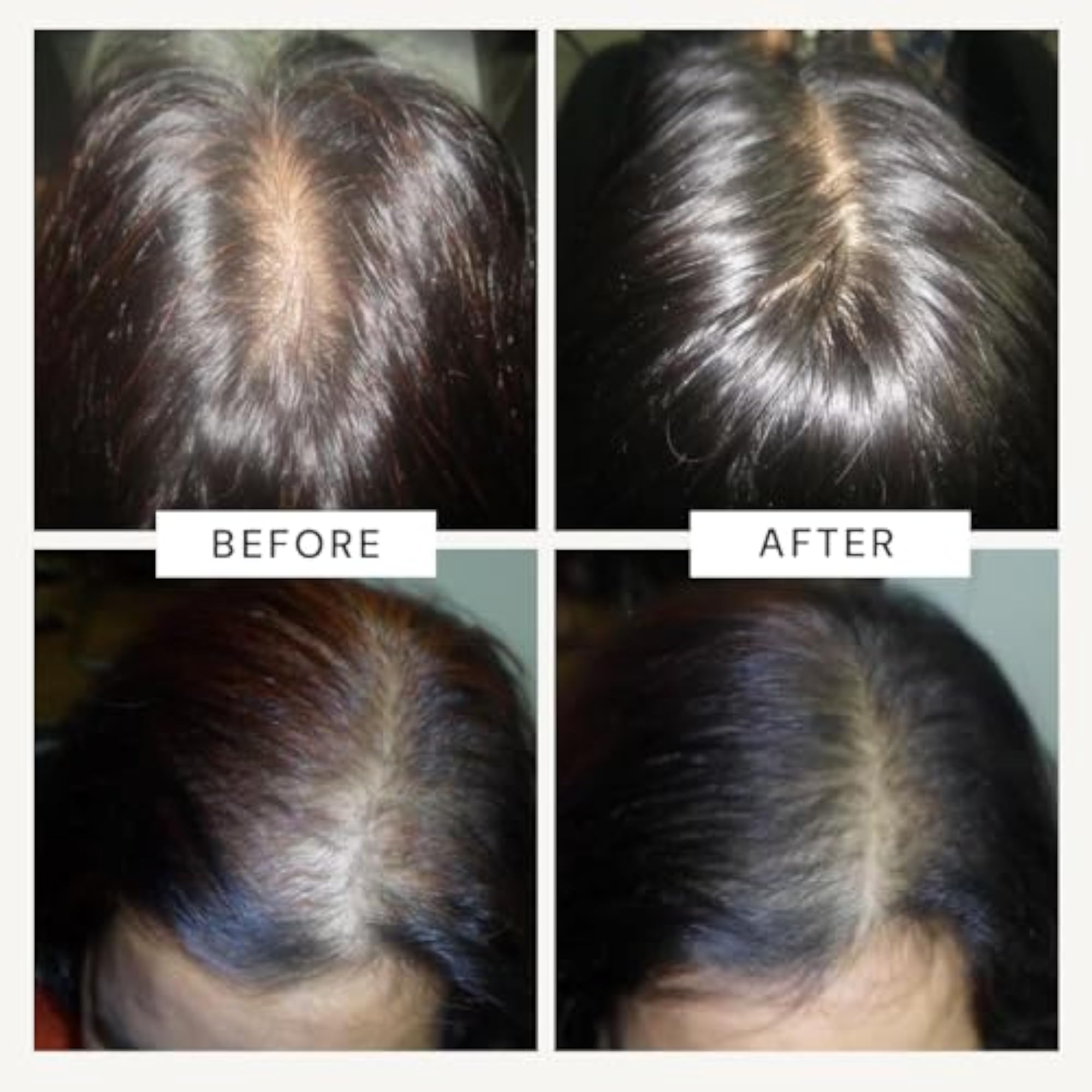 Anagrow® Advanced Hair Regrowth Serum, Swiss Formula