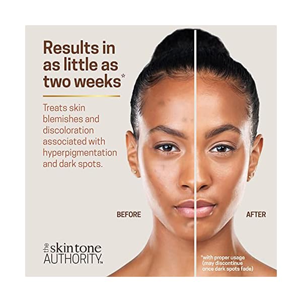 Ambi Fade Cream for Normal Skin, 2 oz (Pack of 3)