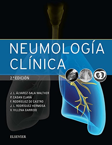 Neumología clínica (Spanish Edition)