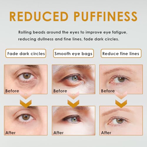 Óleo de rícino Time Eraser, óleo de rícino, bola de olíbano, óleo de rícino para olhos