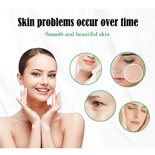 Aichun Beauty Fresh White Honey Shea Butter Moisturizing Cream Remove Pimples Freckles 30Ml #TOP1