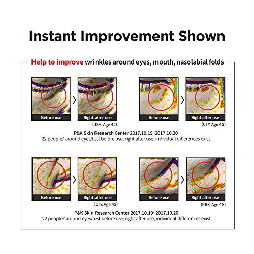 Easydew Dw-Egf Cream Limited 2.4 Oz - Anti-Aging Moisturizer With Human Epidermal Growth Factor & Hyaluronic Acid Collagen To Rejuvenate & Regenerate Cells,Softer Skin, Light Weight Refreshing Cream #TOP7