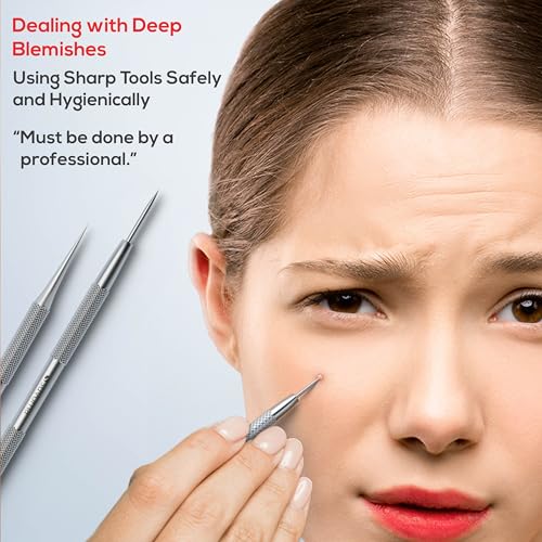 Suvorna Pimple Popper Tool Kit & Milia Remover, 4-Piece Stainless Steel Blackhead Extractor, Whitehead & Comedone Extractor with Lancets for Facial Extraction - Image 6