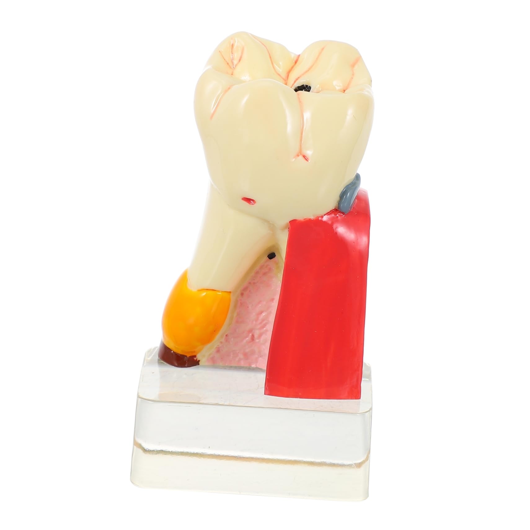 Modello Denti Anatomico Didattico in Resina Beige per Demo | Portatile e Leggero, per Insegnamento Odontoiatrico, Modello Patologico per Studio e Presentazione