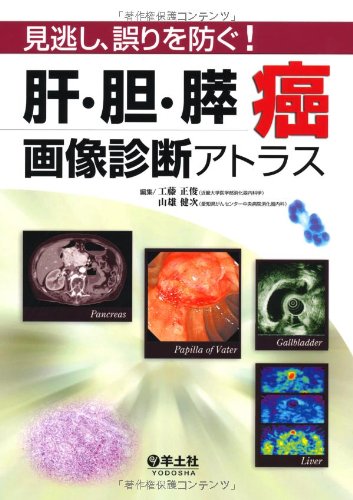 無料電子書籍アプリ 肝・胆・膵癌画像診断アトラス―見逃し、誤りを防ぐ! バイ
