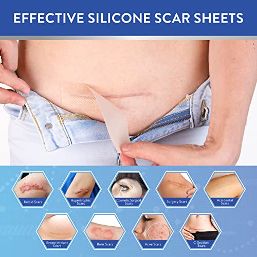 Image of Aroamas Scar Silicone Scar Sheets Scar Removal Silicone Scar Tape 1.6x60 inch for Softening and Flattening Scars, Acne, C-Section, Keloid Surgery, Painless Removal, Reusable, Washable, 6-8 Month Supply