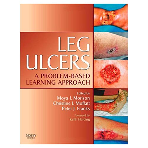 Leg Ulcers: A Problem-Based Learning Approach