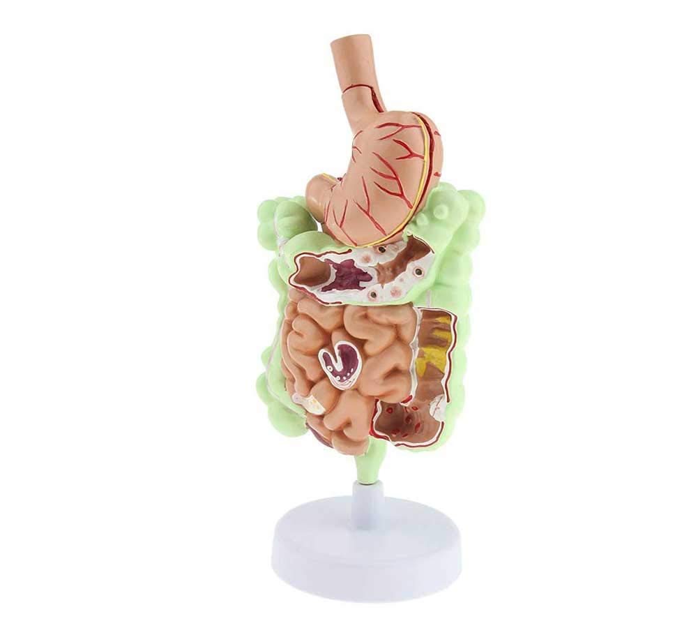 Anatomia patologiczny model ludzkiego okrężnicy model żołądkowo-jelitowy Des digestive do szkoły badania anatomiczne wyświetlacz model szkieletu