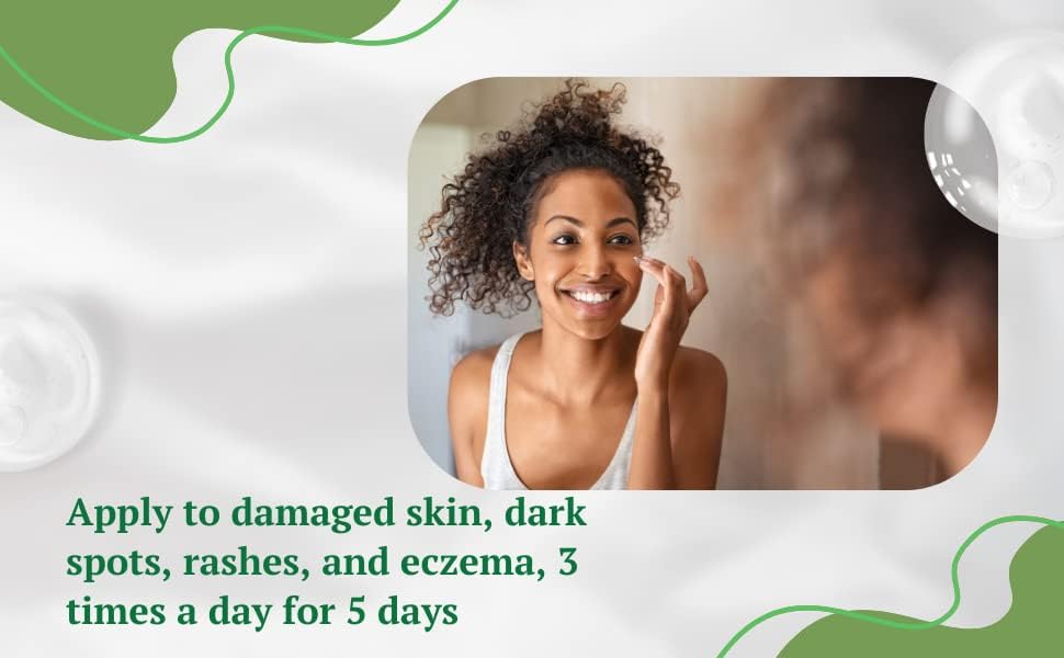 Miniatura 6 de Crema de aloe vera, removedor de manchas oscuras, trata cicatrices viejas y nuevas, crema facial para piel seca, reduce la apariencia de cicatrices