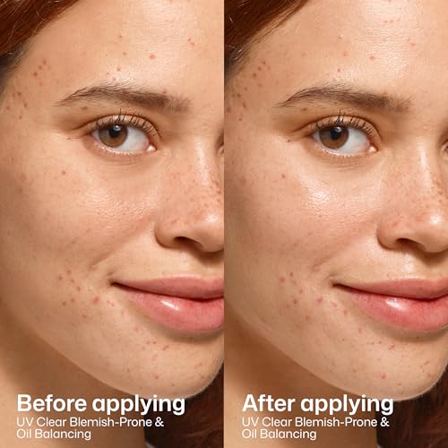 Image of EltaMD UV Clear Face Sunscreen SPF, Oil-Free Sunscreen with Zinc Oxide, Dermatologist Recommended