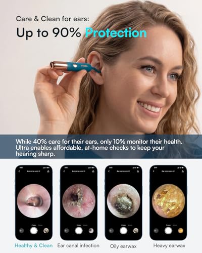 Image of Bebird Earsight Ultra Ear Wax Removal Tool Camera, FSA HSA Eligible Items, 2K HD Ear Cleaner with Flexible Ear Camera Otoscope, Painless Ear Pick Tweezers, Visual Earwax Cleaning Dropper for Family