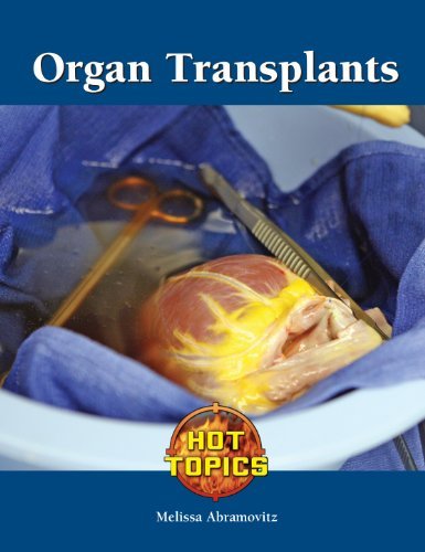 Organ Transplants (Hot Topics)