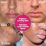 TruSkin Vitamin C Super Serum - Niacinamide, Retinol, Hyaluronic & Salicylic Acid - All-in-One Anti Aging Serum for Face – Improve Appearance of Dark Spots, Firmness for Brighter Looking Skin, 1 Fl Oz - Image 2