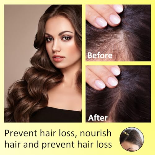 Image of INTIMIFY Ginger Oil For Hair Growth for Women & Men (30 ml)