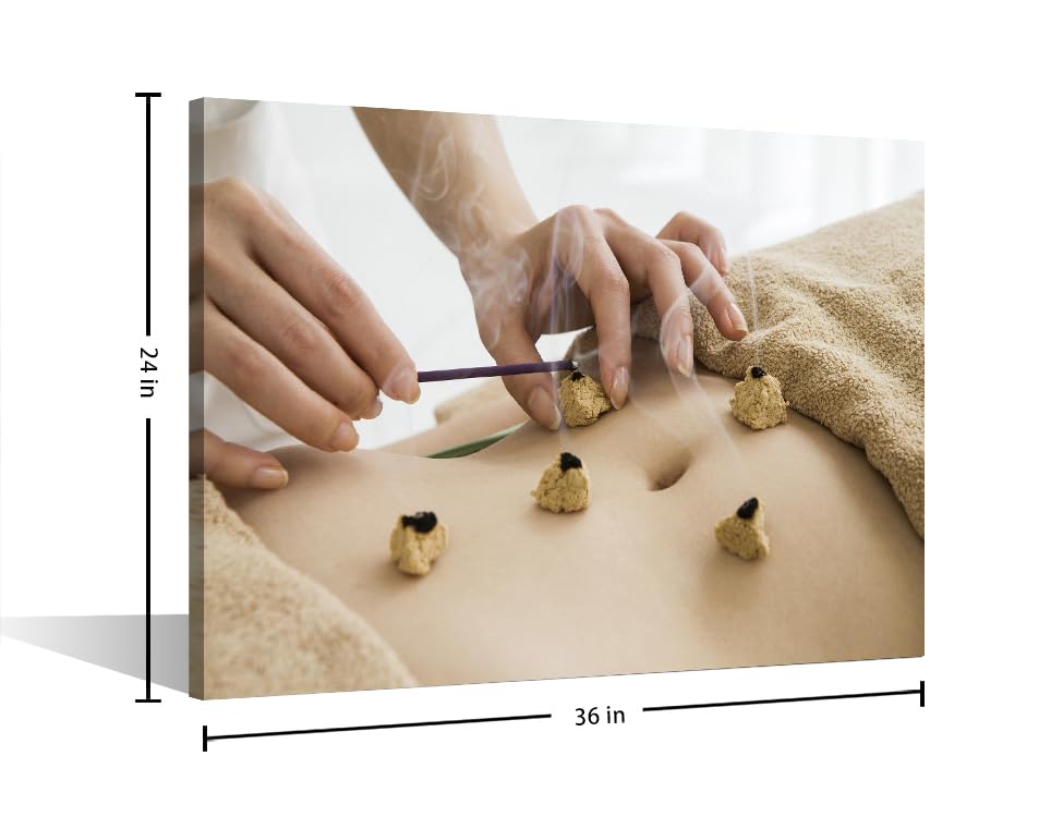 Image of TUMOVO 1 Panels Moxibustion Canvas Wall Art Moxa Moxibustion Posters Paintings for Wall Decorations Nosocomium Artwork Canvas Photo Stretched and Framed Ready to Hang (24 inch Wx36 H)