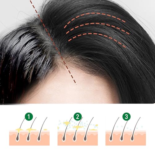 Spray Voluminizador ARANYA para Cabello Graso 150 ml miniatura 6