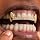 Grillz for Teeth Women Men,Gold Plated Hip Hop Teeth Grills Set, Bling Gem Rapper Jewelry for Music Festival, Stage Performance,Halloween, Cosplay, Rapper Look - 7