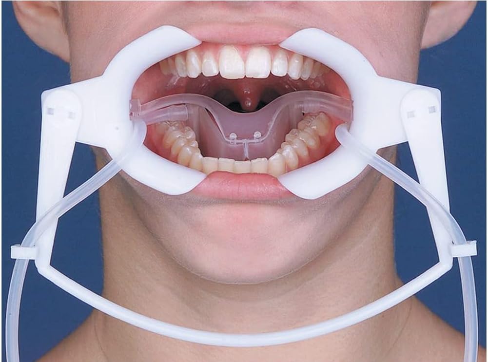 Divaricatore per Labbro monouso Sistema odontoiatrico per Campo Asciutto Orale NOLA Divaricatore ortodontico per sbiancamento dei Denti Divaricatore guance Apribocca Dentale autoclavabile