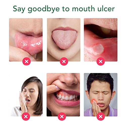 Mundspray Zur Linderung von Mundgeschwüren, Behandlung von Mundgeschwüren, Schutz von Zähnen Und Zahnfleisch, Reduzierung von Mundgeruch, Linderung von Mundtrockenheit, Behandlung von Mundgeschwüren, – Bild 6