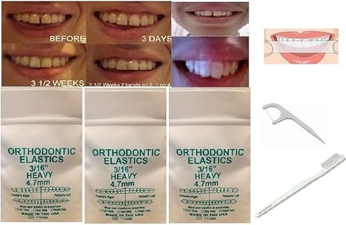 Bandas dentales de ortodoncia con tiras blanqueadoras, hilo dental y cepillo de dientes envuelto