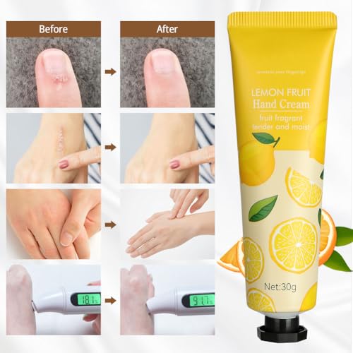 LOPHE Hand Cream, 5 x 30g Moisturising Hand Cream with Natural Plant Flower Fruit Flavour Gentle, Travel Size - Image 3