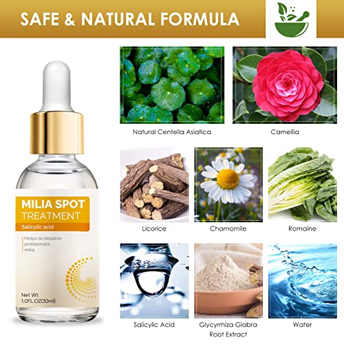 buying guides for best skin tag removal MiliaRemover MiliaTreatment