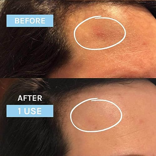 Evolve Organic Beauty - Natural Blue Velvet Serum with Ceramides, Squalane and Blue tansy | Certified Natural Vegan Cruelty-free Clean Beauty (1.0 fl oz | 30 mL) - Image 3