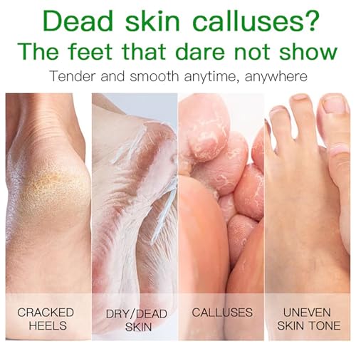 3 Pairs Foot Peel Mask – Aloe Vera Exfoliating Foot Peel Mask - Foot Mask Peel for Dry, Cracked Heels & Calluses – Moisturising Foot Peel Socks - Peeling Foot Mask for Hydrating & Softening - Image 3