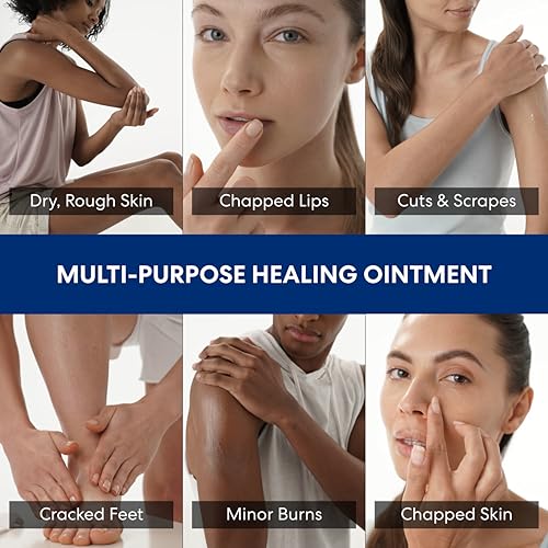 Palmer's Healing Ointment, Cocoa Butter Formula with Vitamin E (3.75 Oz) - image 2