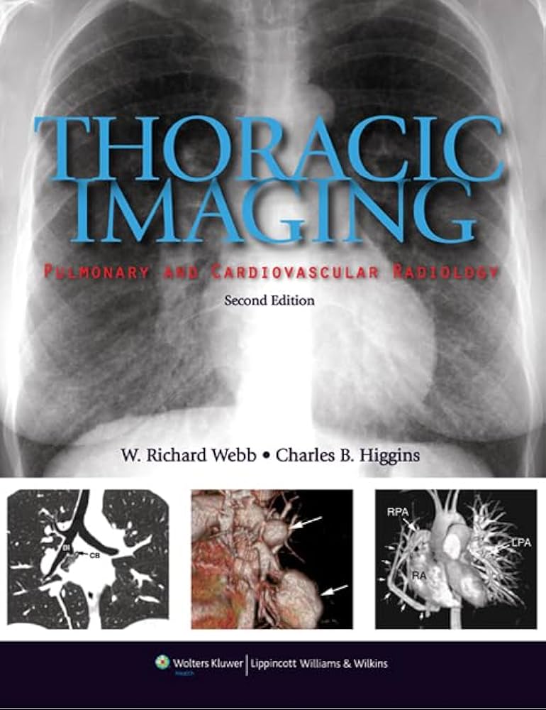 Amazon | Thoracic Imaging: Pulmonary and Cardiovascular